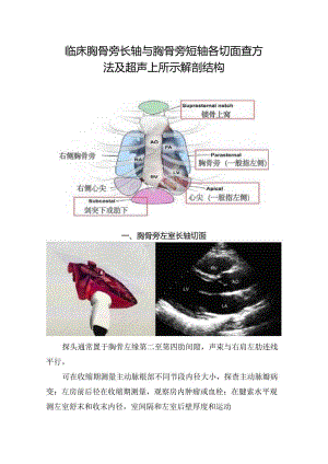 临床胸骨旁长轴与胸骨旁短轴各切面查方法及超声上所示解剖结构.docx