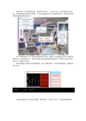 PiCCO在ICU中的应用探讨.docx