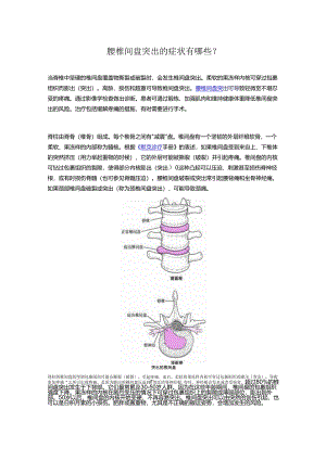 腰椎间盘突出的症状有哪些？.docx