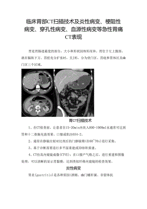 临床胃部CT扫描技术及炎性病变、梗阻性病变、穿孔性病变、血源性病变等急性胃痛CT表现.docx