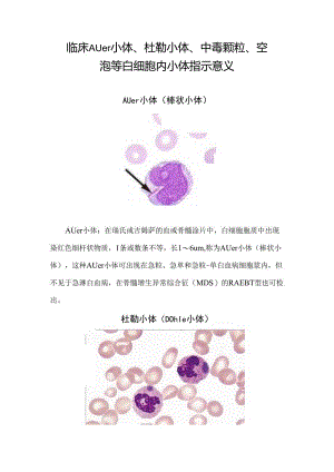 临床Auer小体、杜勒小体、中毒颗粒、空泡等白细胞内小体指示意义.docx