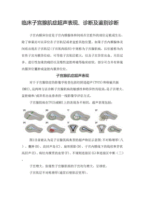 临床子宫腺肌症超声表现、诊断及鉴别诊断.docx