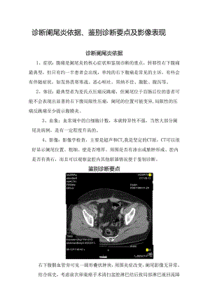 诊断阑尾炎依据、鉴别诊断要点及影像表现.docx