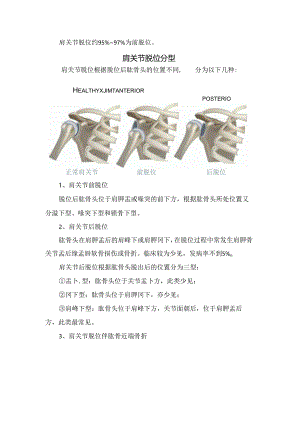 临床肩关节解剖、肩关节前脱位分型、诊断、复位方法、康复及总结.docx