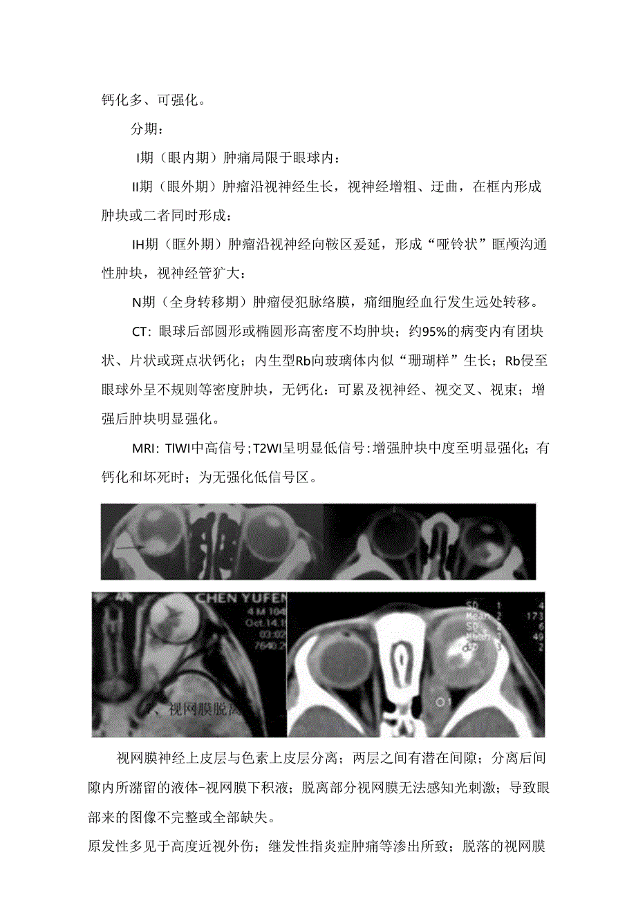 临床先天性小眼球、屈光不正、眼球破裂、视网膜脱离等眼球内疾病影像表现及疾病分期.docx_第3页