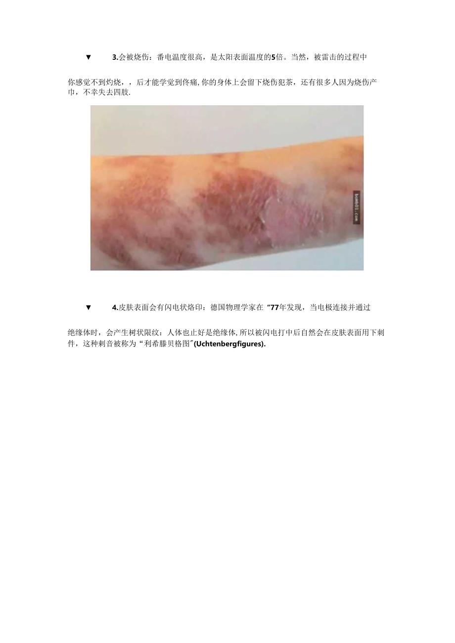 被雷劈是种什么样的体验？.docx_第2页