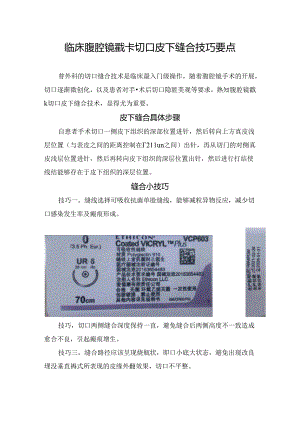 临床腹腔镜戳卡切口皮下缝合技巧要点.docx