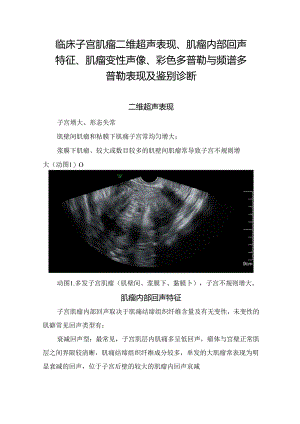 临床子宫肌瘤二维超声表现、肌瘤内部回声特征、肌瘤变性声像、彩色多普勒与频谱多普勒表现及鉴别诊断.docx
