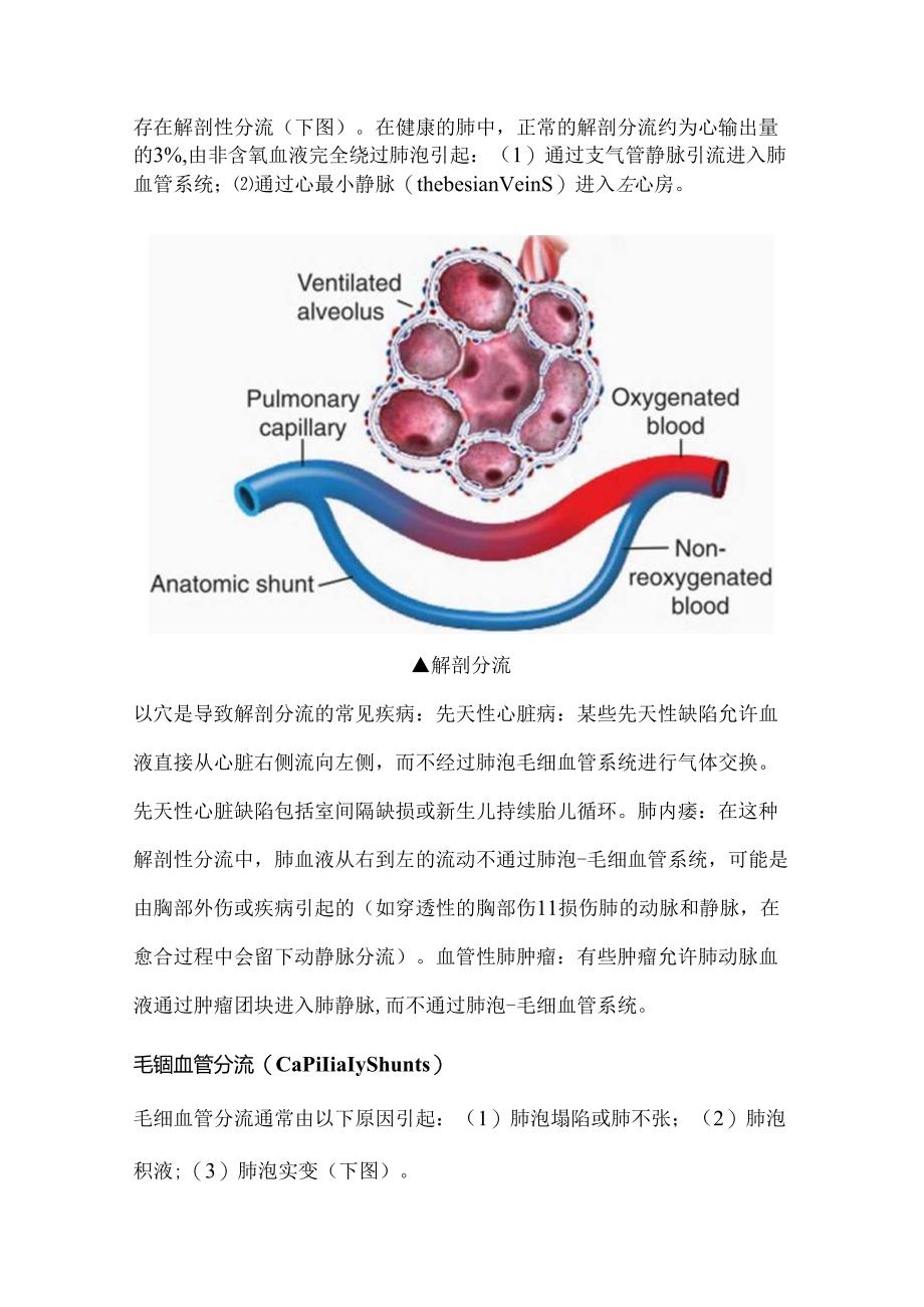 2024肺分流知识科普(附图表).docx_第2页