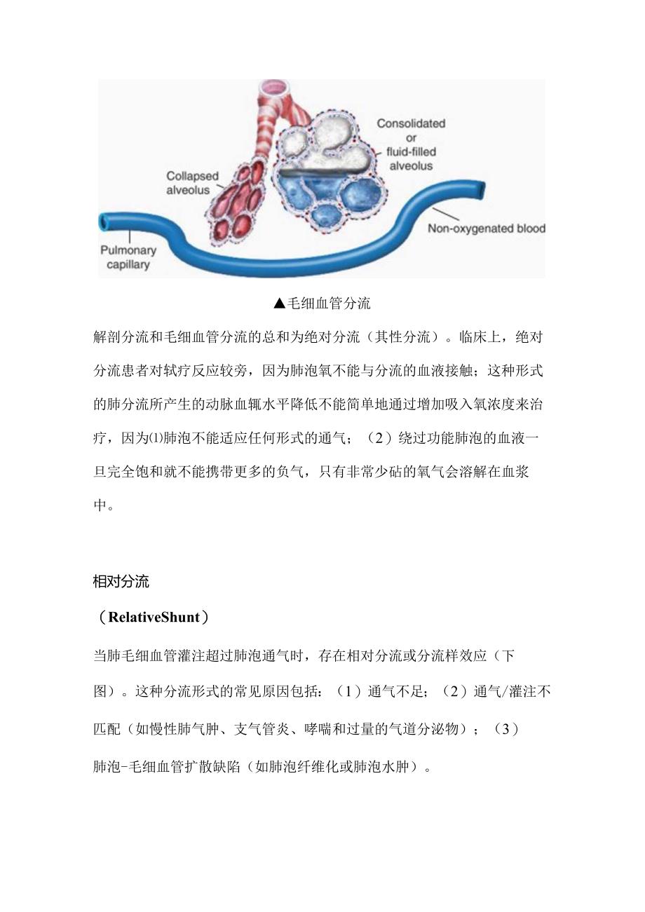 2024肺分流知识科普(附图表).docx_第3页