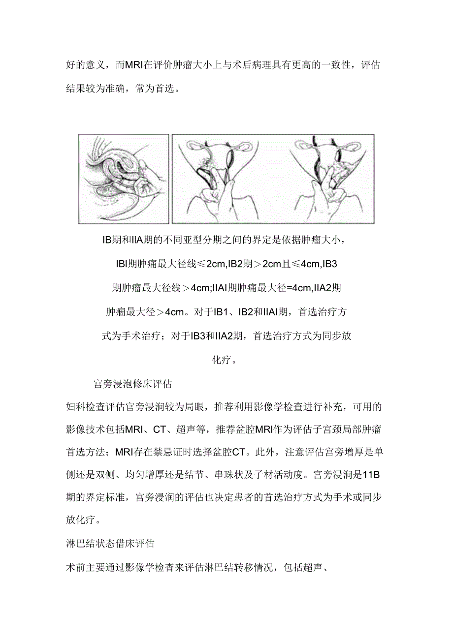 宫颈癌术前精准评估对治疗选择的指导意义2024（全文）.docx_第3页