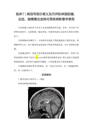 临床T1高信号指示意义及胼胝体脂肪瘤、出血、脑梗塞出血转化等疾病影像学表现.docx