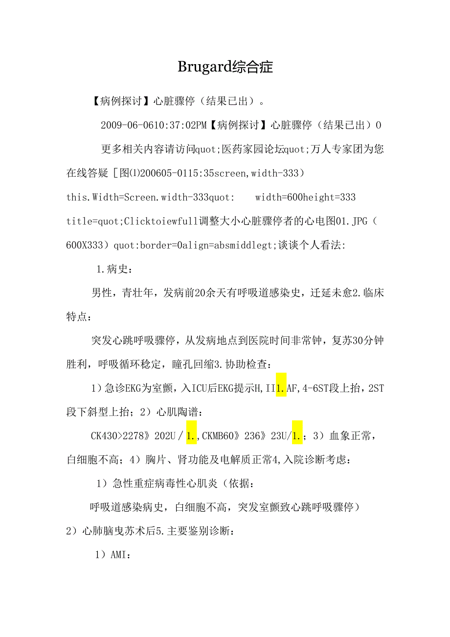 Brugard综合症_0.docx_第1页