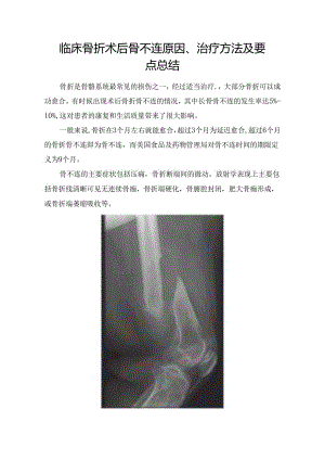 临床骨折术后骨不连原因、治疗方法及要点总结.docx