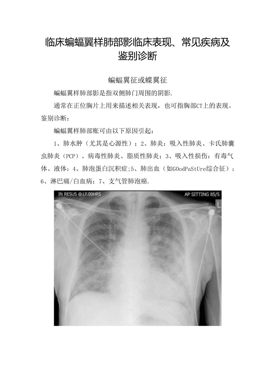临床蝙蝠翼样肺部影临床表现、常见疾病及鉴别诊断.docx_第1页
