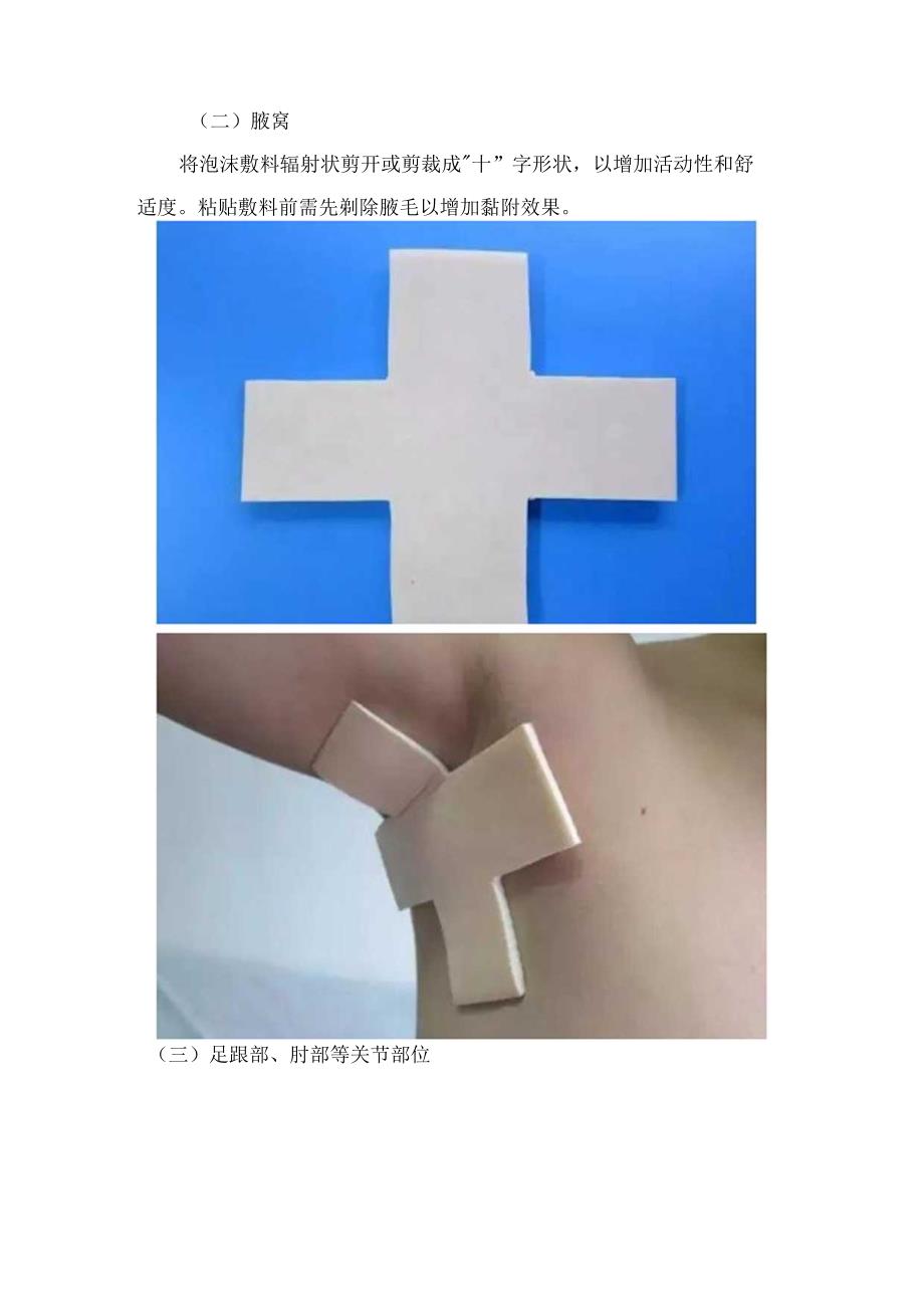 临床护理自粘型新型伤口敷料固定、特殊部位敷料粘贴技巧及免缝胶带粘贴技巧.docx_第3页