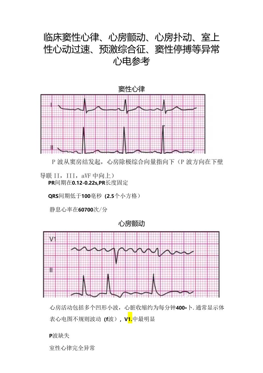 临床窦性心律、心房颤动、心房扑动、室上性心动过速、预激综合征、窦性停搏等异常心电参考.docx_第1页