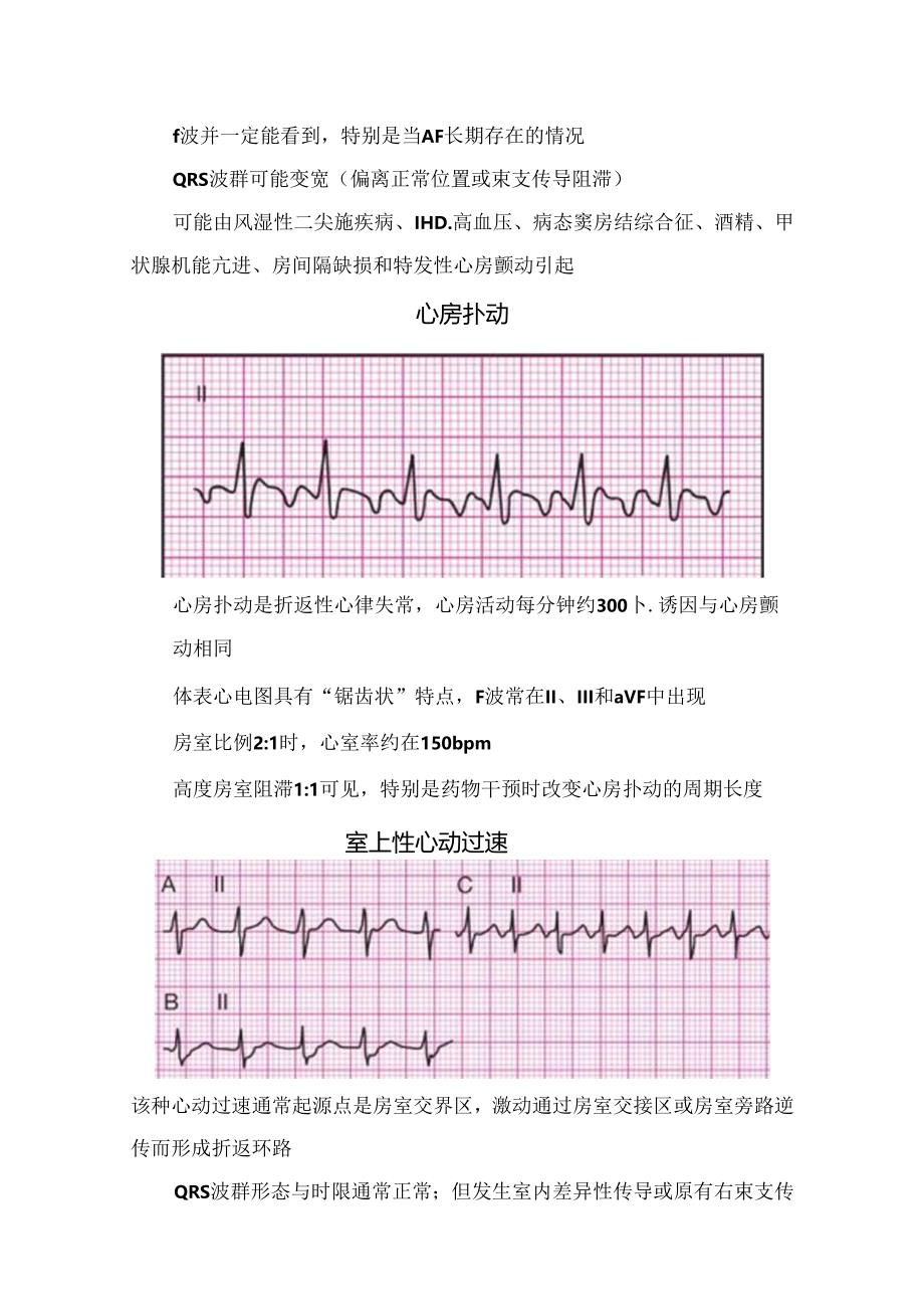临床窦性心律、心房颤动、心房扑动、室上性心动过速、预激综合征、窦性停搏等异常心电参考.docx_第2页