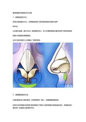 医美鼻整形鼻基底术式分解.docx