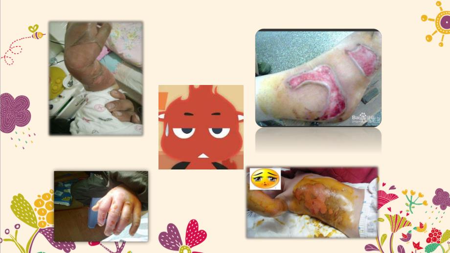 大班安全《远离烫烫小怪兽》PPT课件教案微课件.pptx_第3页