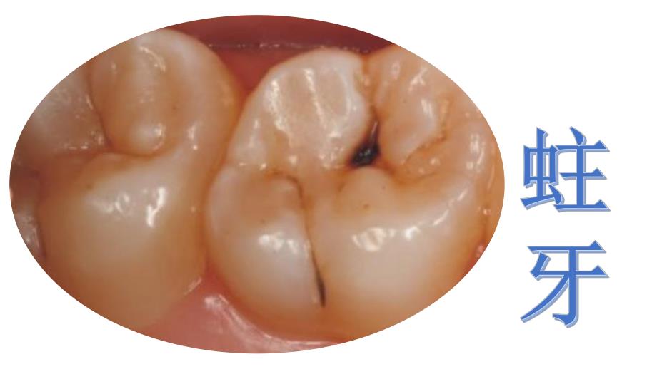 大班健康《保护牙齿》PPT课件教案大班健康《保护牙齿》微课件.pptx_第3页