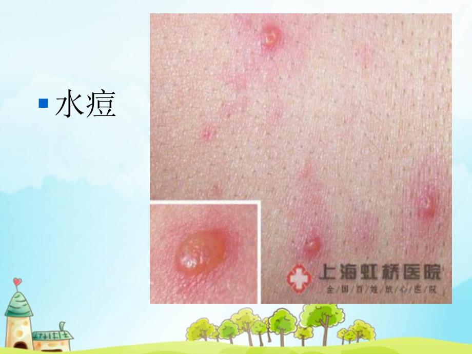 大班健康《幼儿园传染病防治》PPT课件教案1366026522.ppt_第3页