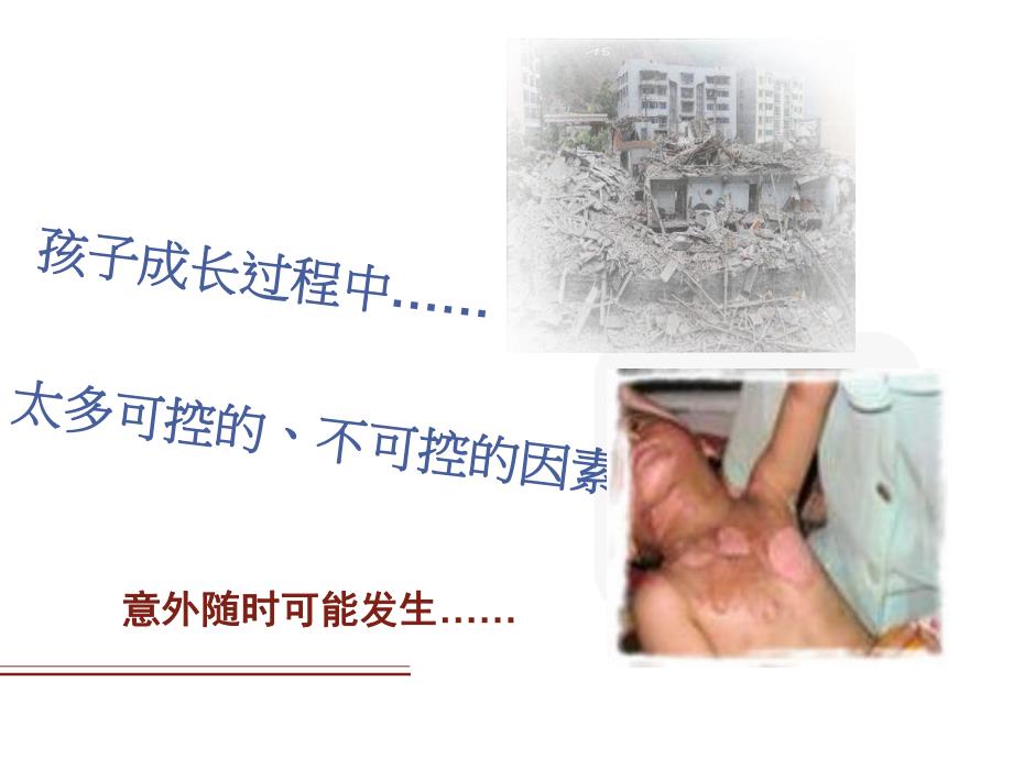 幼儿园意外伤害的早期处理PPT课件幼儿园意外伤害的早期处理PPT课件.ppt_第3页