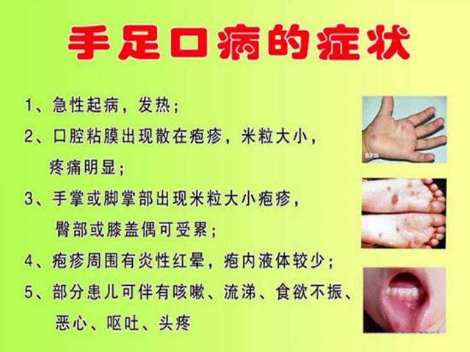 幼儿园疾病防控知识PPT课件.ppt_第3页
