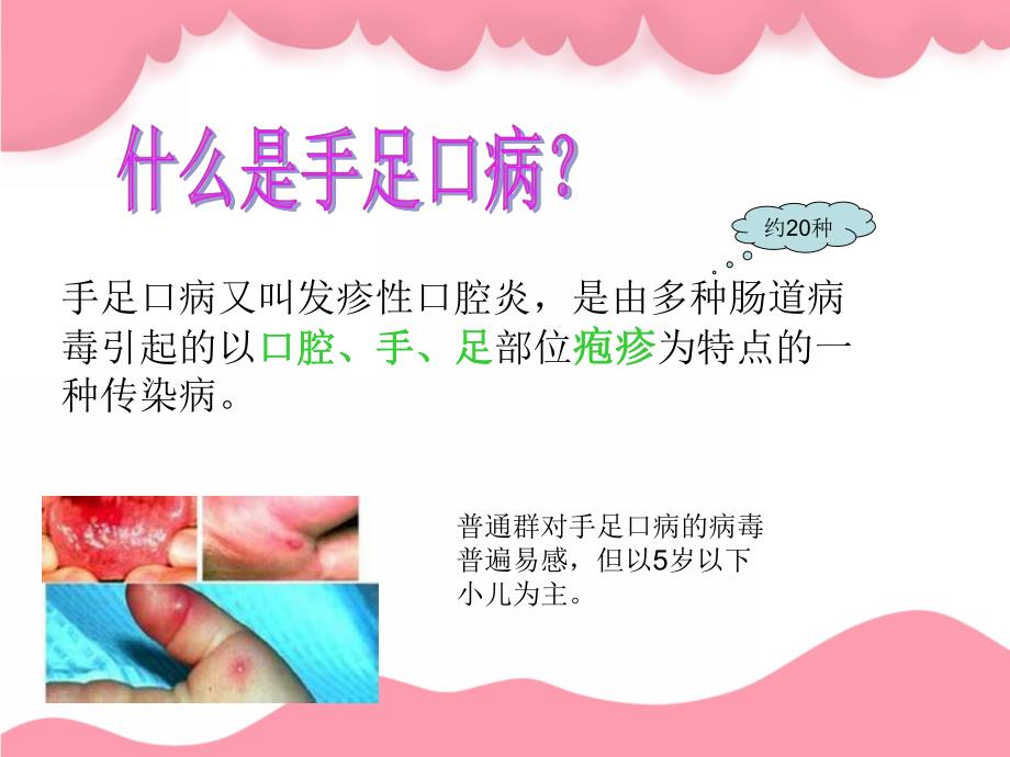 幼儿园儿童常见传染病的预防PPT课件儿童常见传染病的预防.pptx_第3页