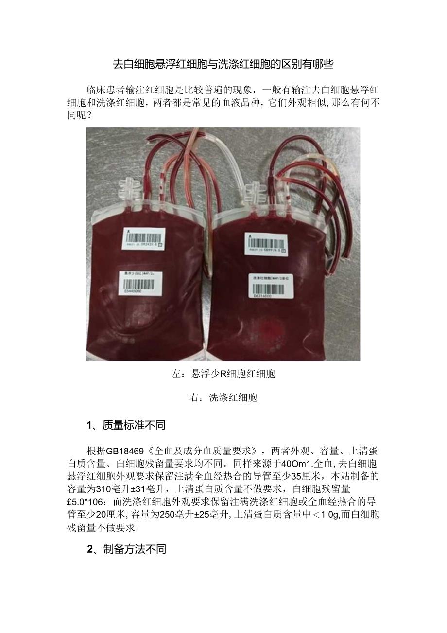 去白细胞悬浮红细胞与洗涤红细胞的区别有哪些.docx_第1页
