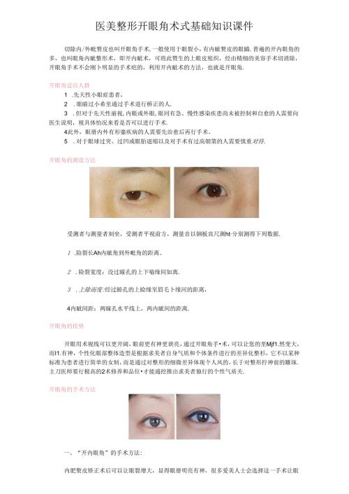 医美整形开眼角术式基础知识课件.docx