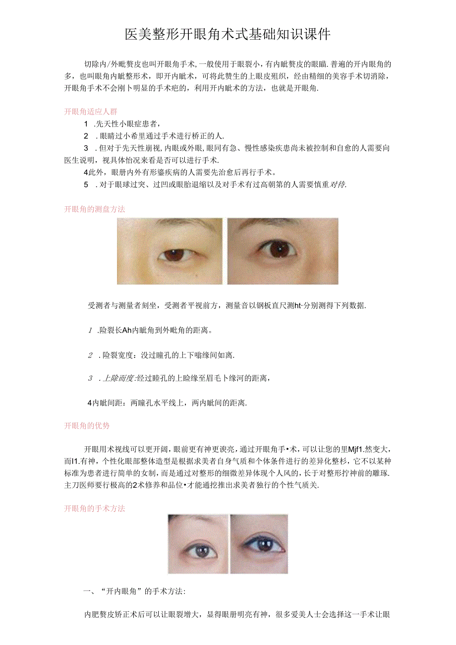 医美整形开眼角术式基础知识课件.docx_第1页