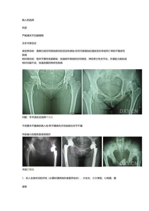 初次全髋置换术的手术技术和容易出现的问题.docx