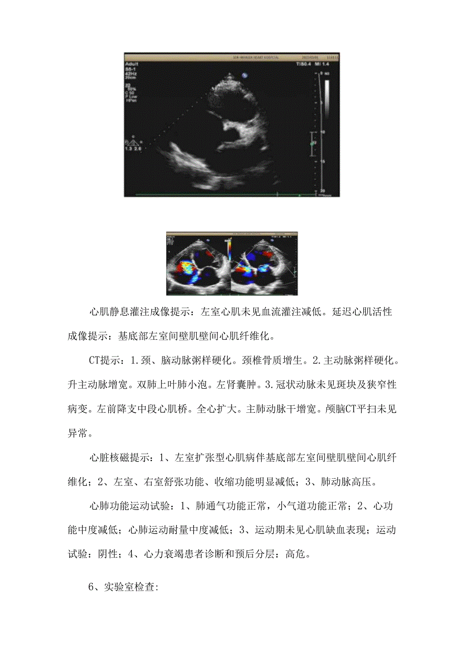 一例肝素诱导血小板减少症病史患者的心脏移植诊疗分析.docx_第3页