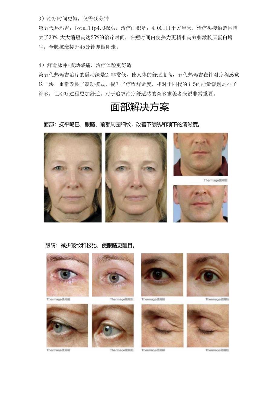 医美抗衰美容设备热玛吉常见问题话术.docx_第3页