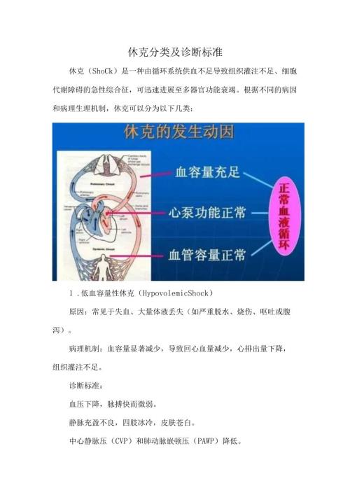 休克分类及诊断标准.docx