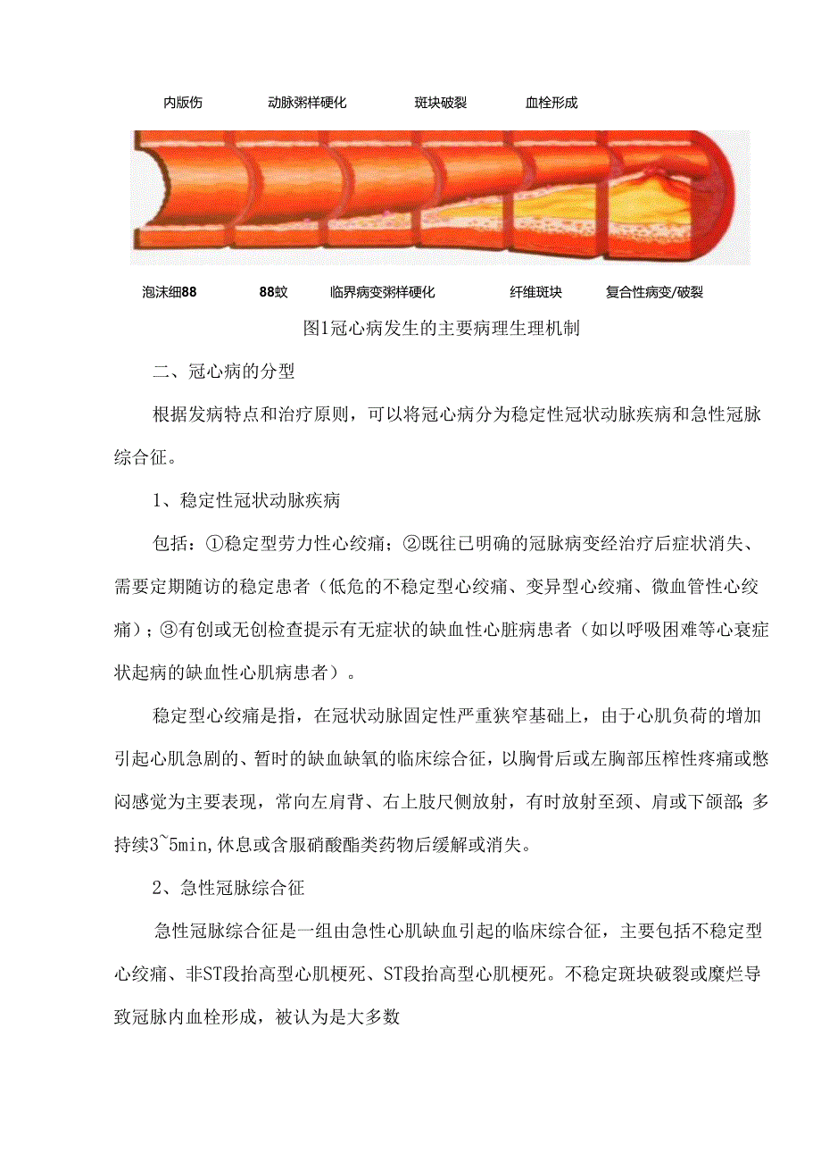 冠心病心绞痛的诊断、分型和防治原则.docx_第2页