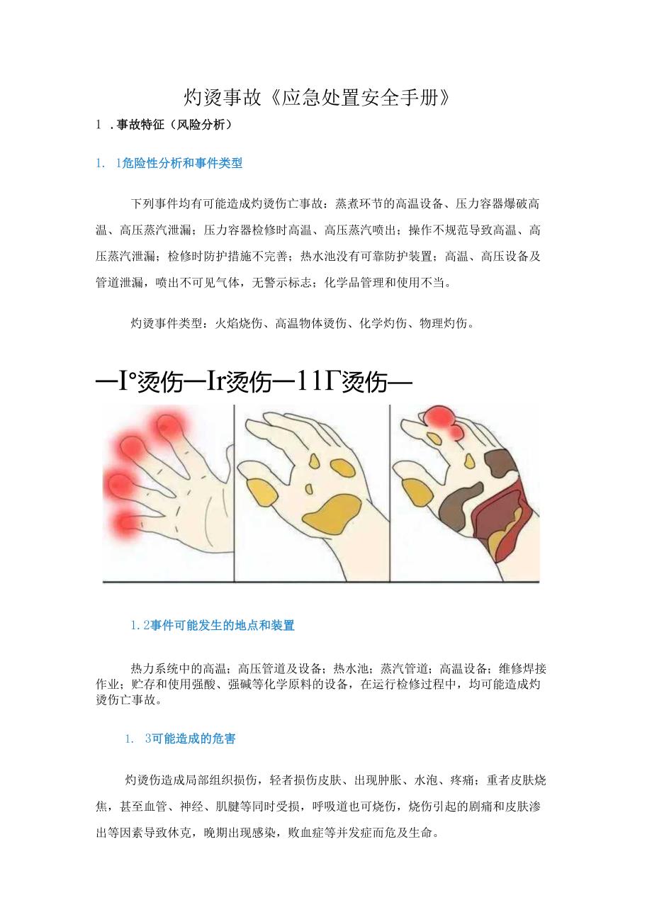 灼烫事故《应急处置安全手册》.docx_第1页