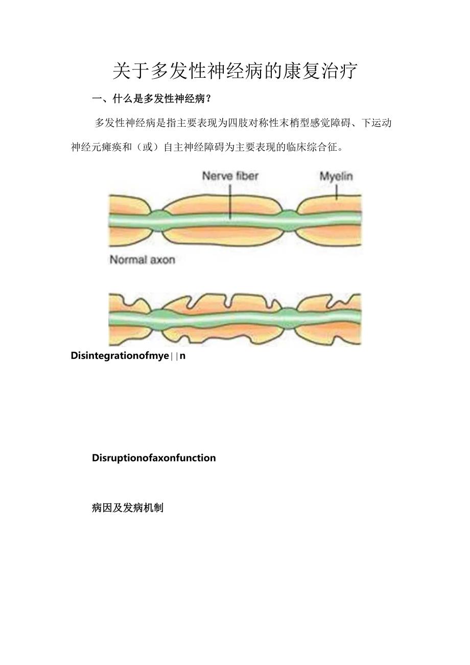 关于多发性神经病的康复治疗.docx_第1页