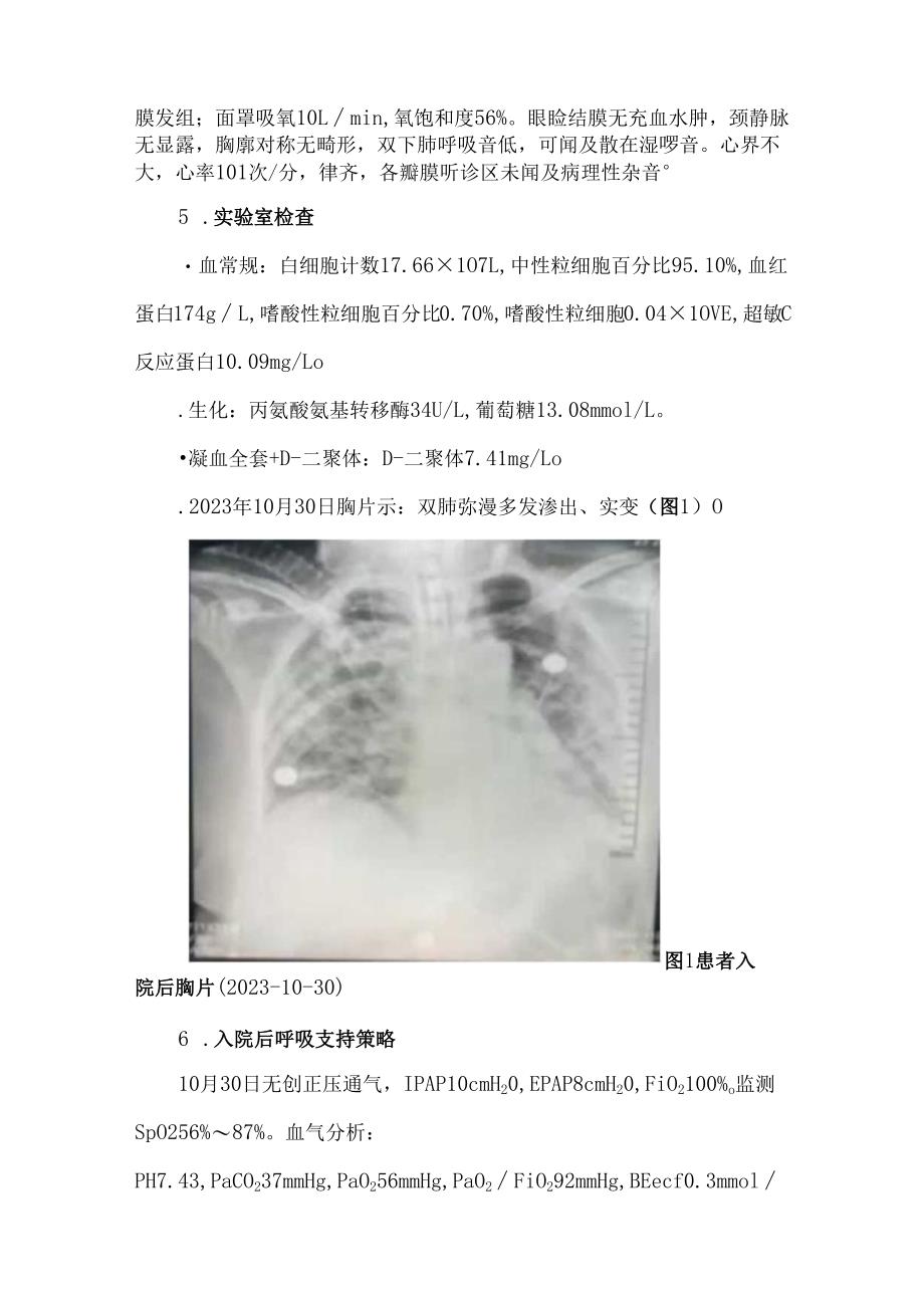 呼吸力学导向的机械通气策略在ARDS中的应用.docx_第2页