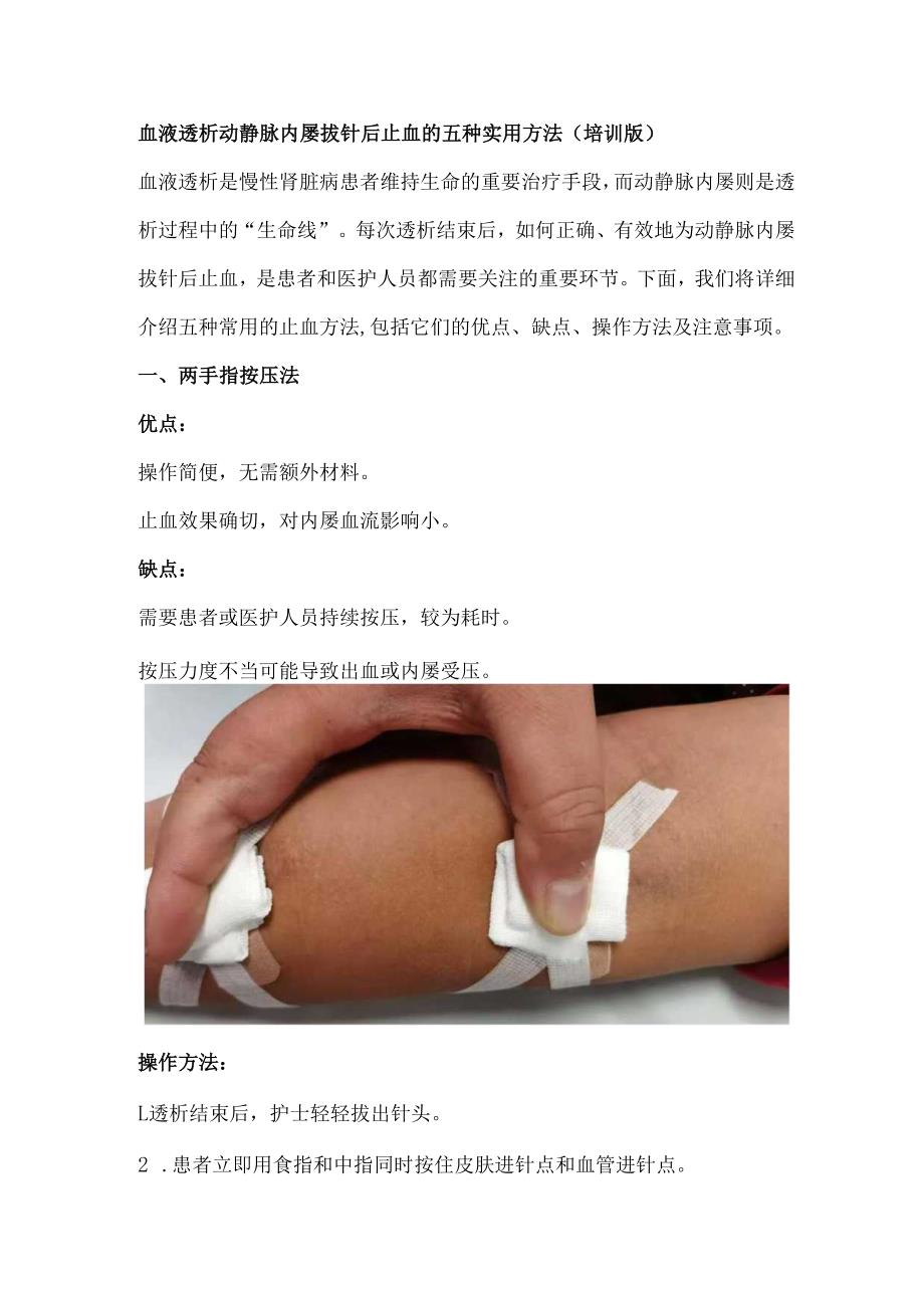 血液透析动静脉内瘘拔针后止血的五种实用方法（培训版）.docx_第1页